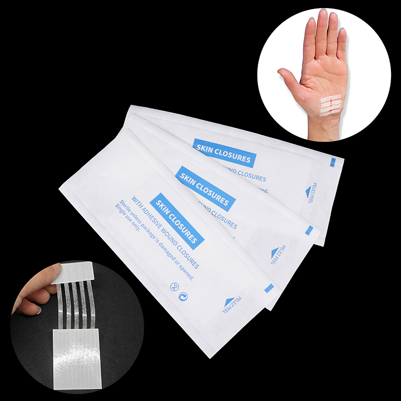 Sterile Streifen Narbe weg Akn – Strapless Bra Adhesive Bewertung und Preis